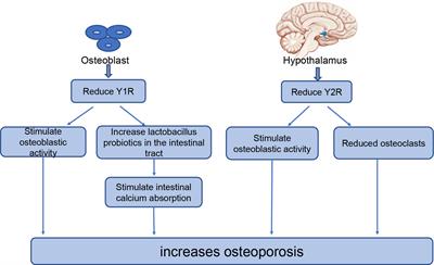 Update on the Role of Neuropeptide Y and Other Related Factors in Breast Cancer and Osteoporosis